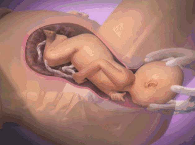 胎儿娩出期