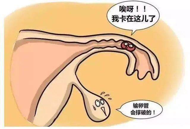 输卵管完全不通